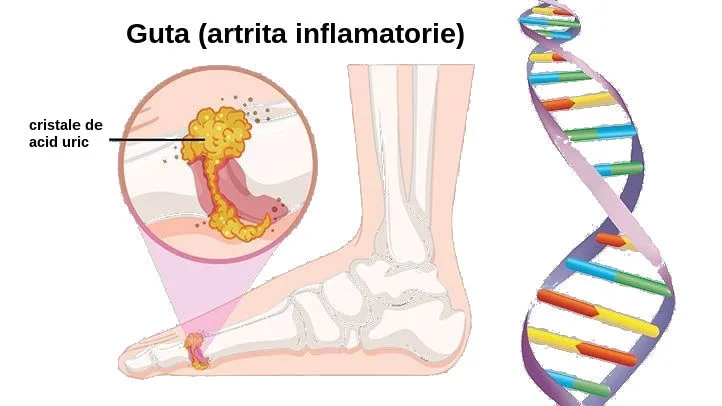 Diagrama descompunerii purinelor și eliminarea acidului uric din organism